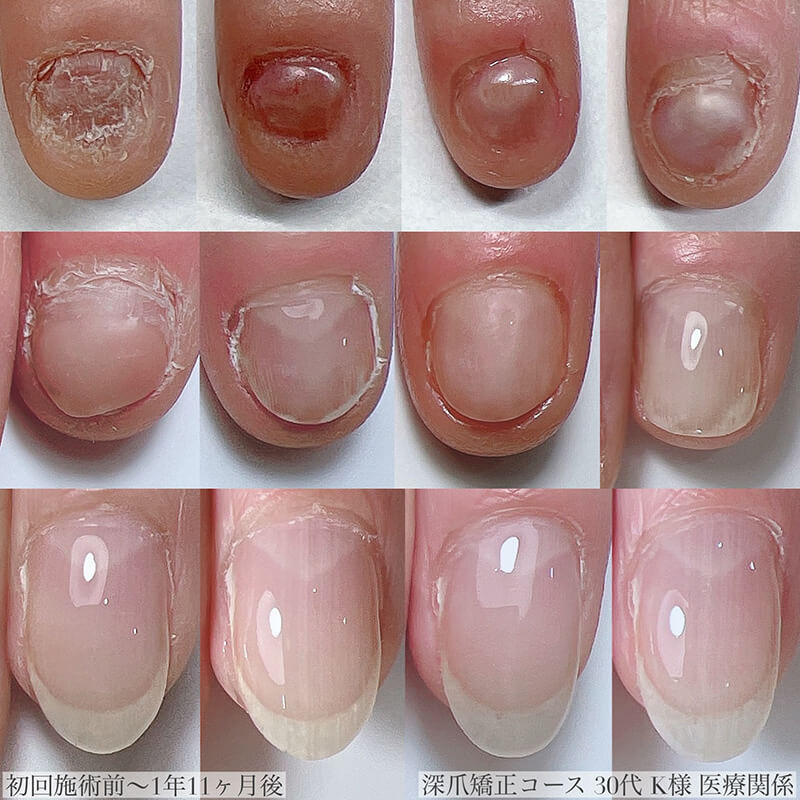 30代 K様