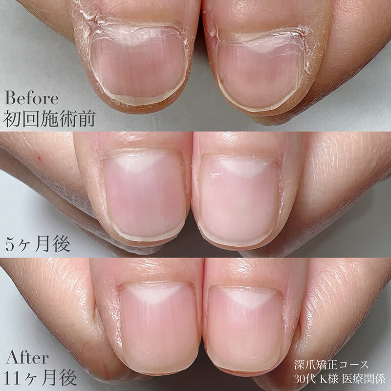 30代 K様