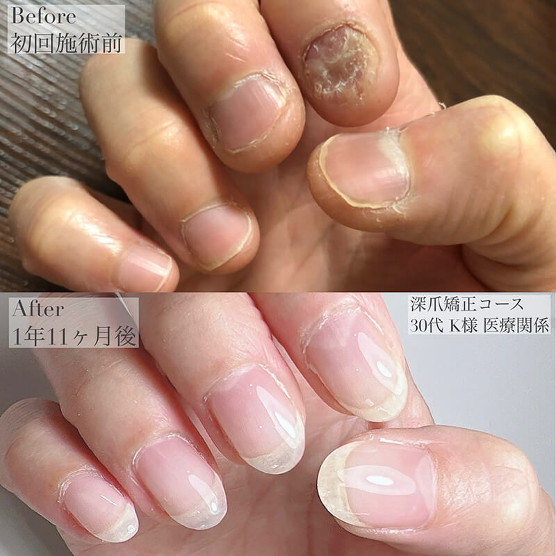 30代 K様
