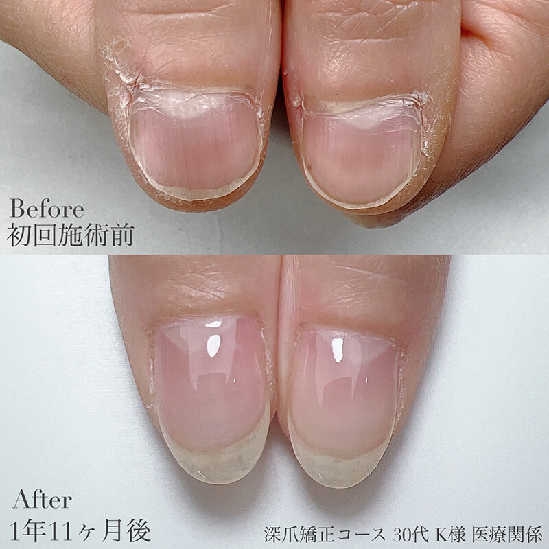 30代 K様