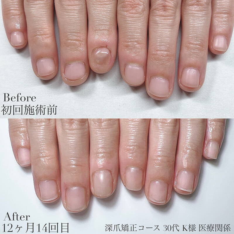 30代 K様