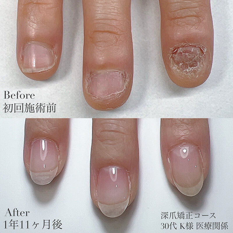 30代 K様