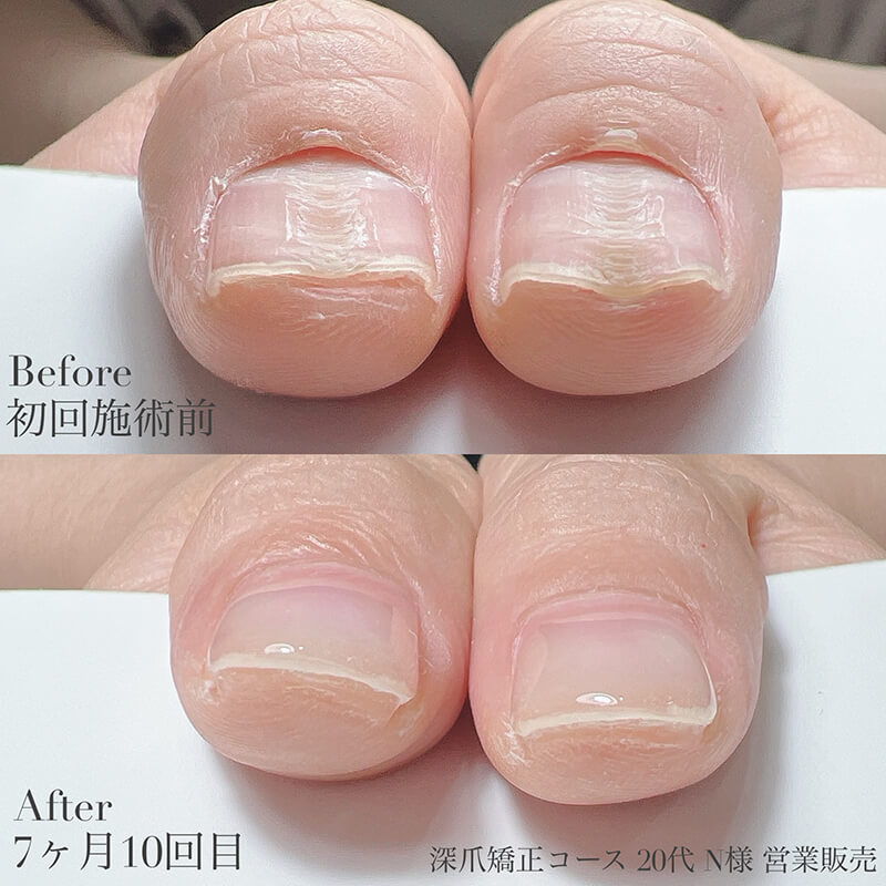 20代 N様