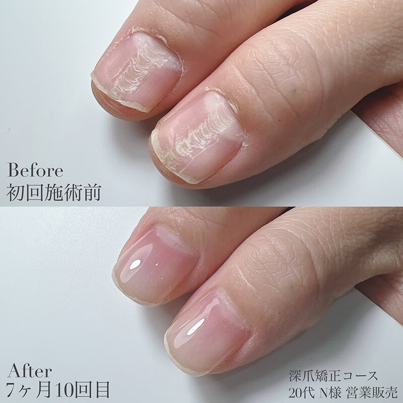 20代 N様