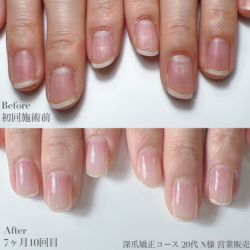 20代 N様