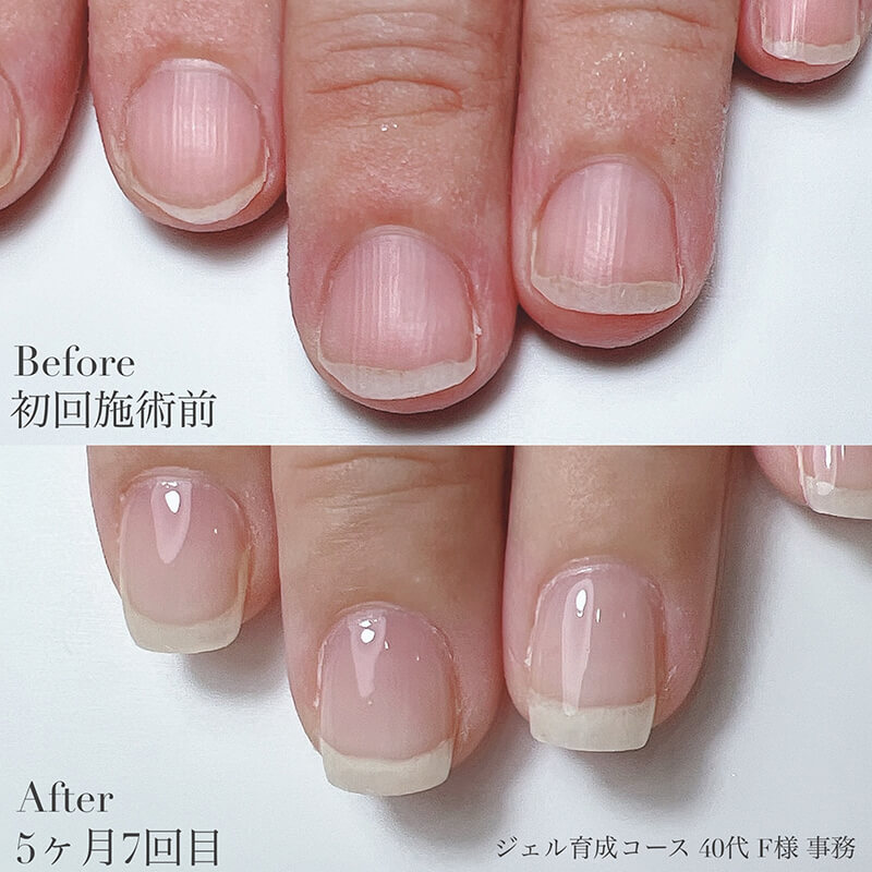 40代 F様