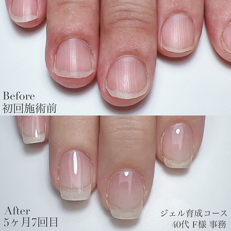 40代 F様
