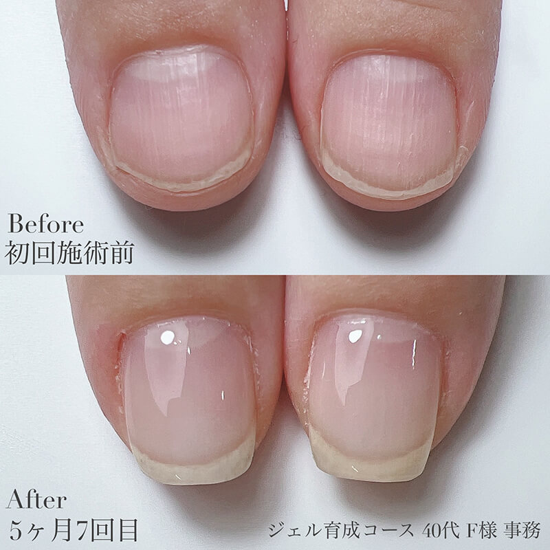 40代 F様