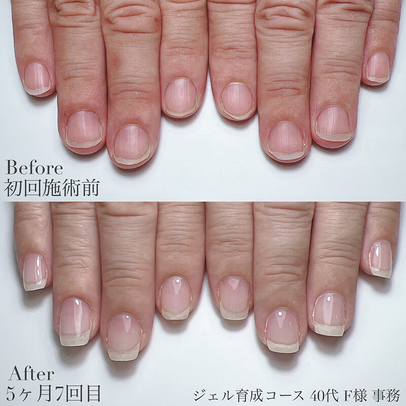 40代 F様