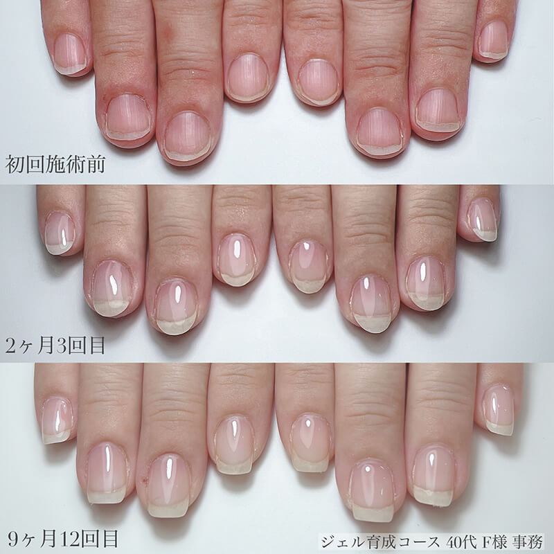 40代 F様