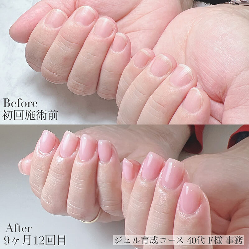 40代 F様
